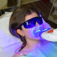 Gallery Photo of Teeth Whitening