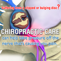 Gallery Photo of Chiropractic can be a non-surgical solution.