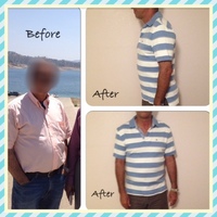 Gallery Photo of Weight loss patient