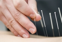 Gallery Photo of Traditional Chinese Medicine and Acupuncture