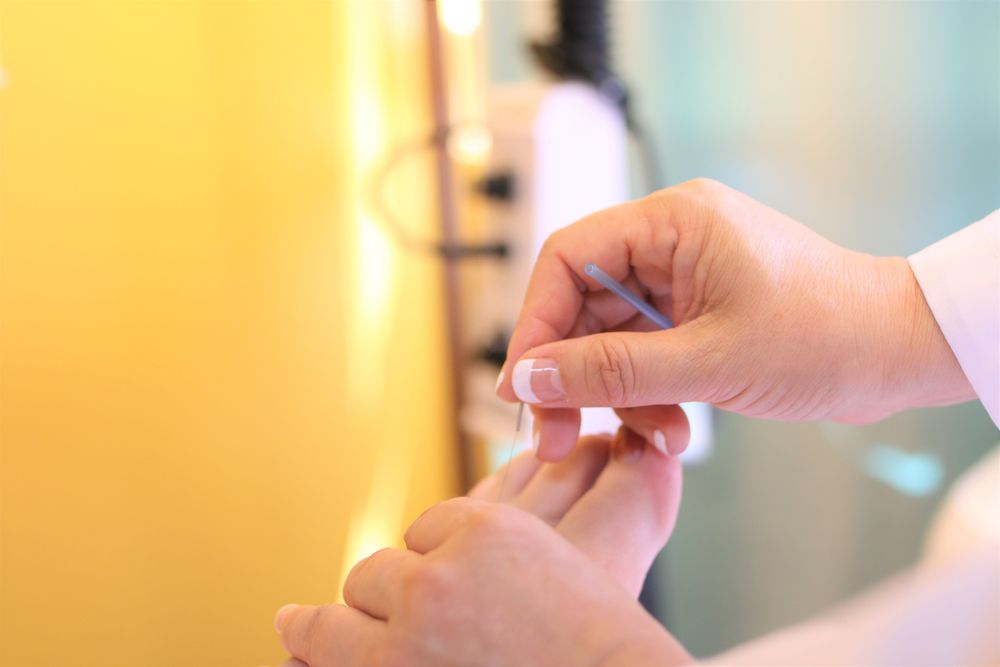 Healing Tree Acupuncture & Wellness Center, Inc, Acupuncturist