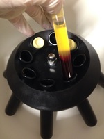 Gallery Photo of Platelet Rich Plasma processing