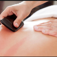 Gallery Photo of Gua Sha Therapy