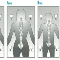 Gallery Photo of Spine specialists with back pain, and neck pain